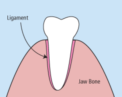 dental extractions at best kids dentist in Aliso Viejo