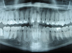 digital dental x-ray at best kids dentist